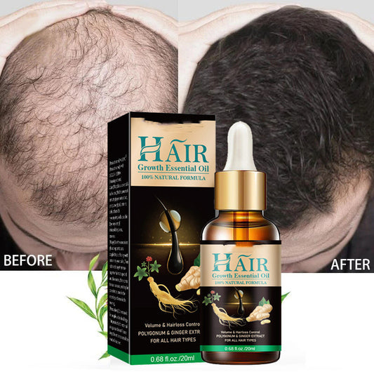 Fashion Simple Ginger King Hair Nutrient StoreToBuyNow