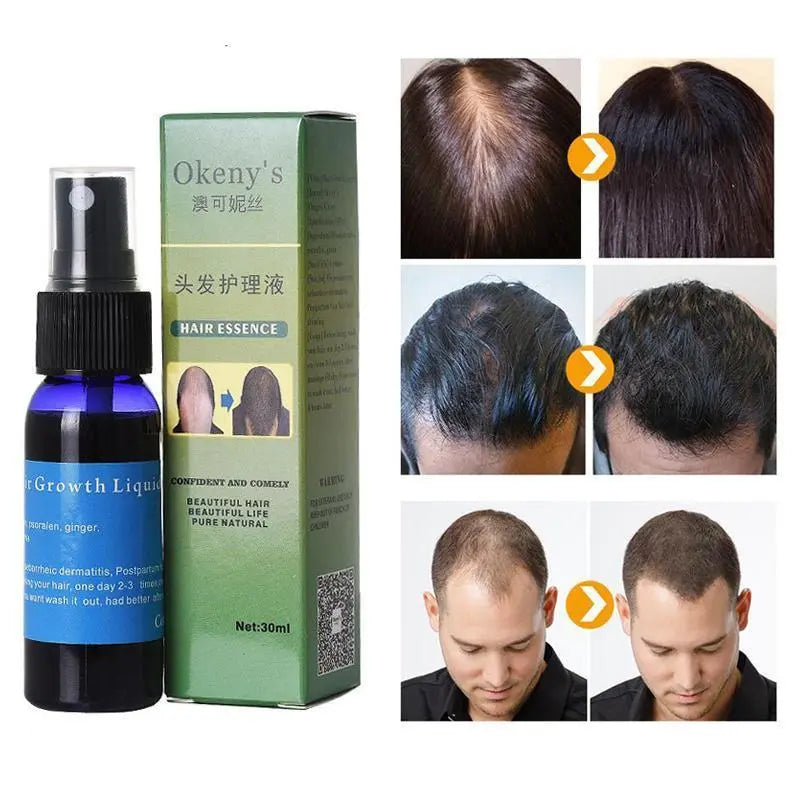 Sunburst Hair Growth: Revitalizing Hair Care for Women & Men StoreToBuyNow