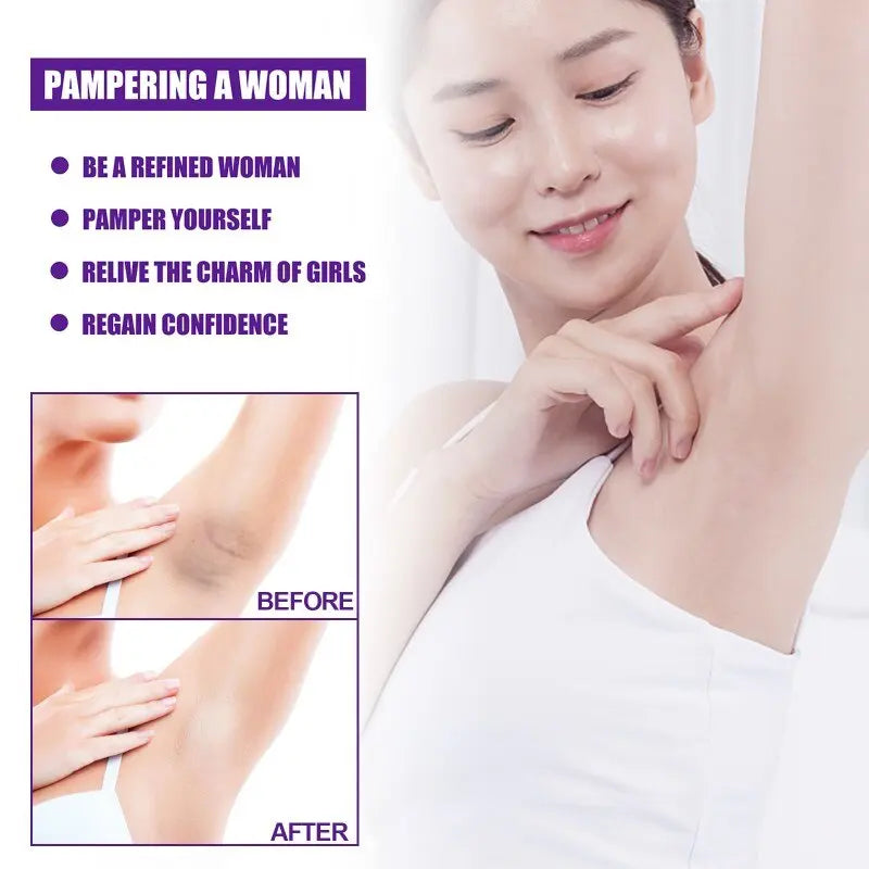 Whitening Cream Private Parts Underarm Bleaching Serum Whiten Butt Knee Brighten Inner Thigh Intimate Parts Dark Remove Melanin StoreToBuyNow