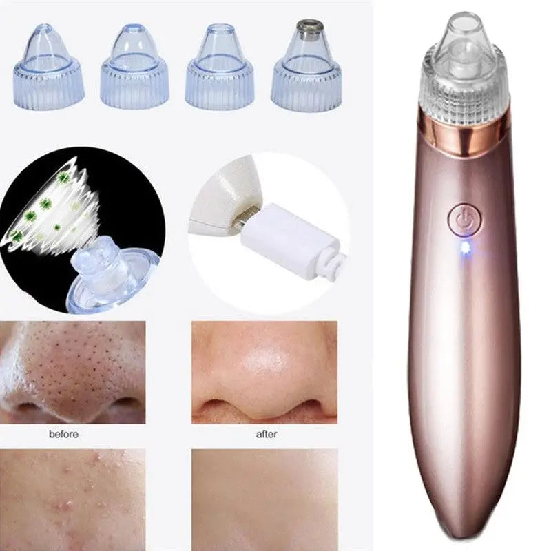 Your Ultimate Blackhead Beauty Companion StoreToBuyNow