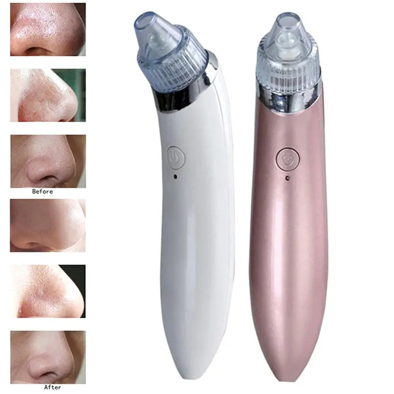 Your Ultimate Blackhead Beauty Companion StoreToBuyNow